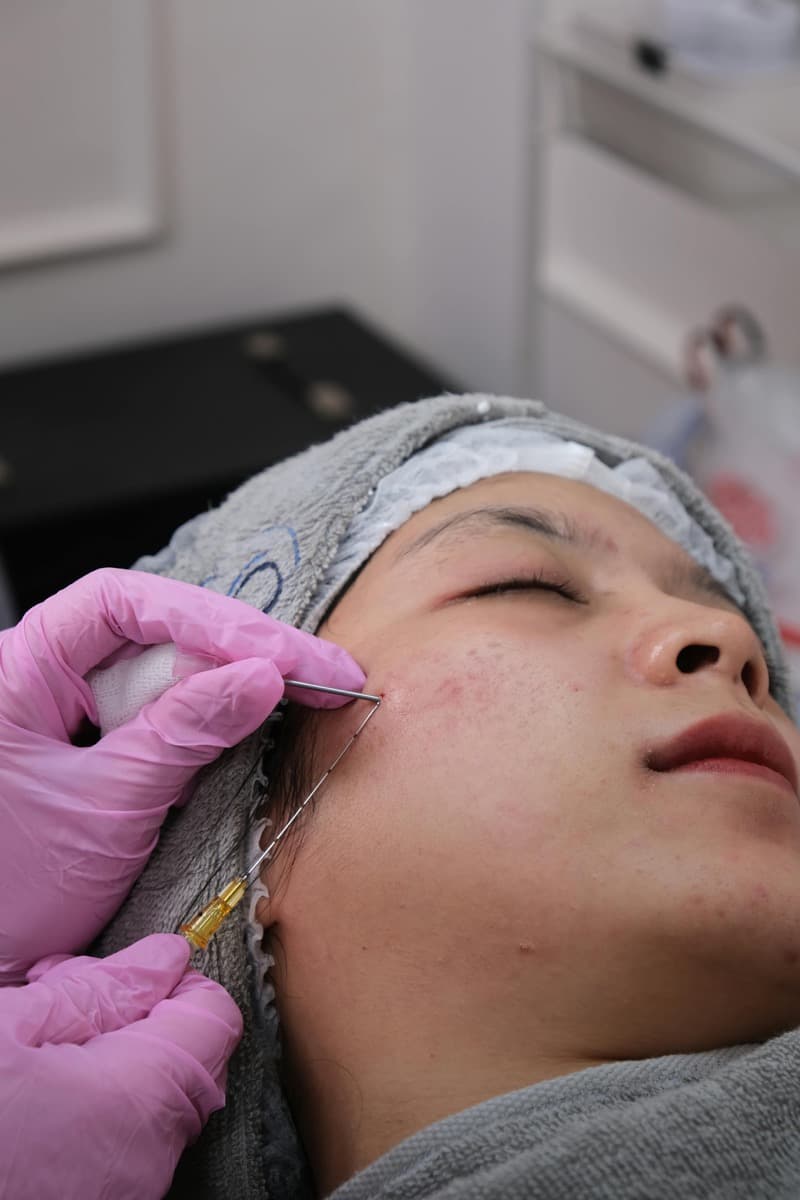 Biolifting
